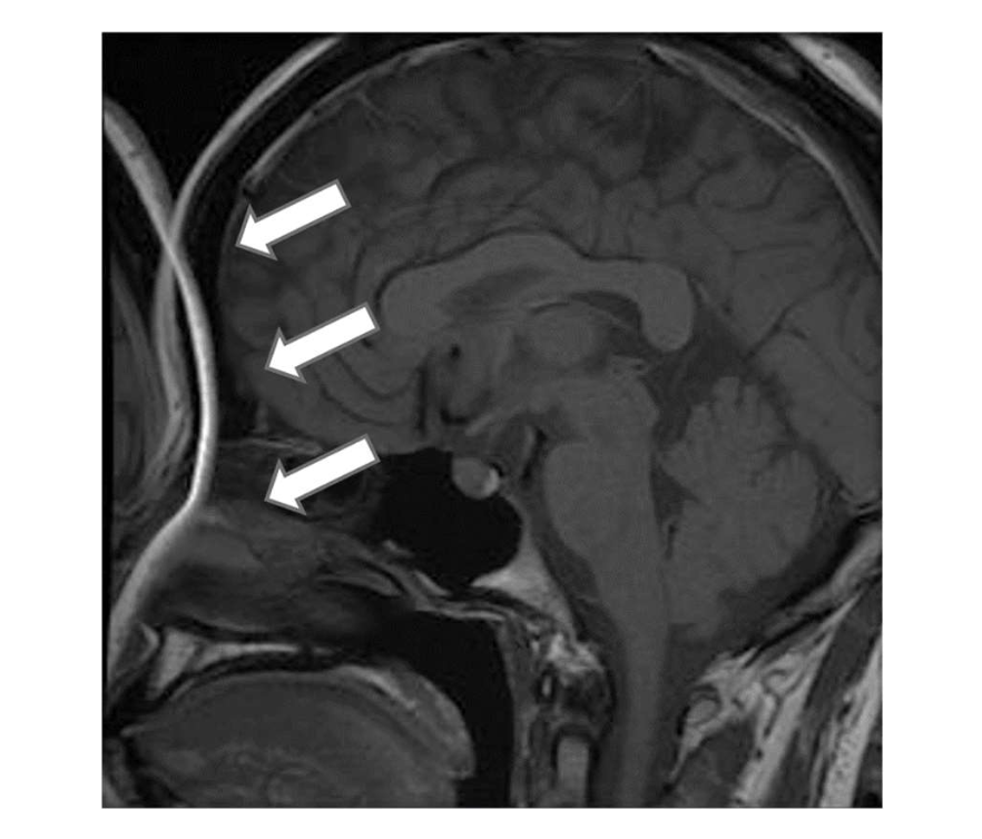 第13回 Mri専門技術者認定試験 過去問 ラドライフ