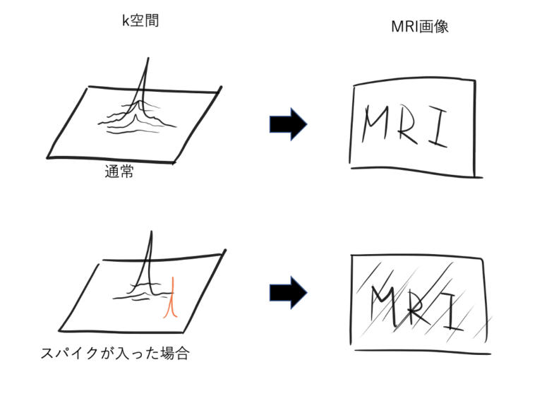Herringbone artifact(ヘリンボーンアーチファクト) ラドライフ